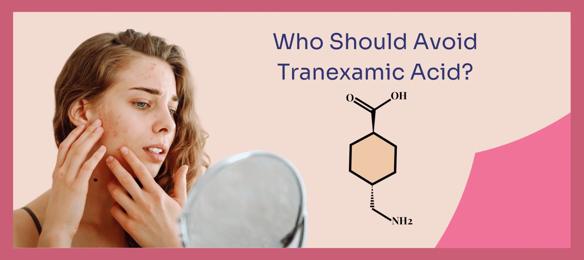 网红“氨甲环酸”被批准用于色斑治疗了吗？